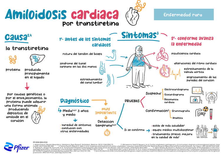 Amiloidosis Cardíaca por transtiretina (ATTR-CM) - Infografía