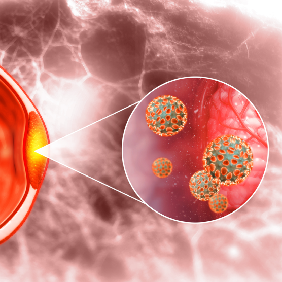 Conoce más sobre la hiperplasia prostática benigna