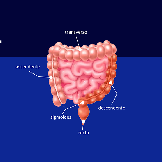 Cáncer colorrectal metastásico